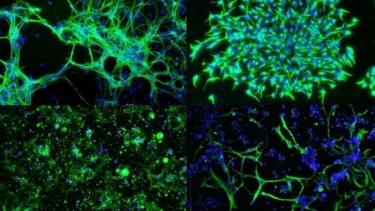 High Efficiency mRNA Delivery??