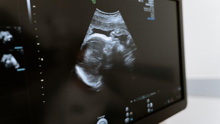 Why Is the US Against Embryo DNA Modification?
