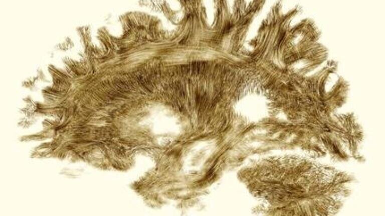 Wellcome Image Award; Dr Flavio Dell’Acqua