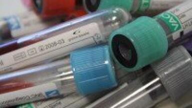 Partnership Brings NIPT Test to Poland