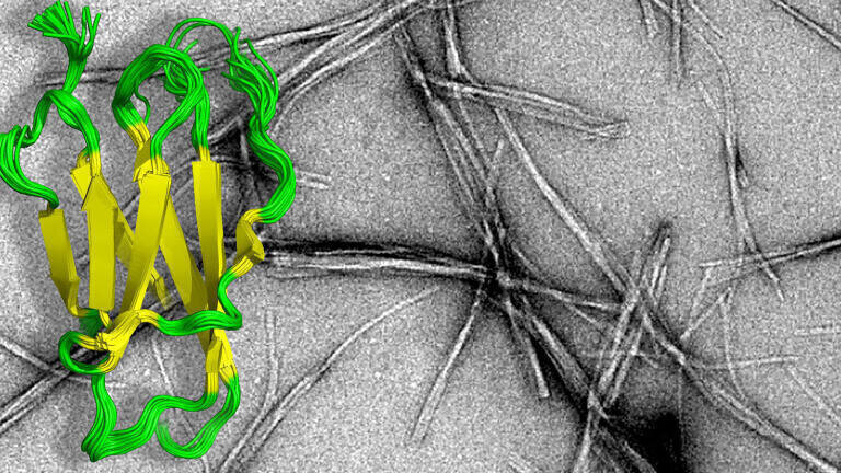 The image shows the aggregates (grey) that cause amyloid diseases (such as Alzheimer’s) and the protein that forms these aggregates (green and yellow).