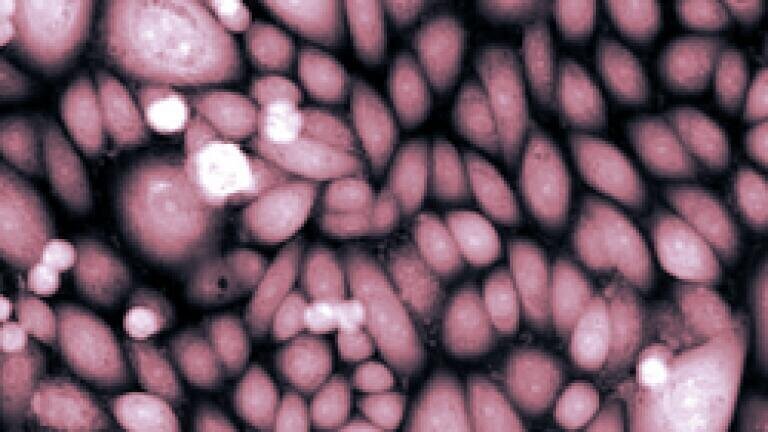 Scientists Discover Link to Treatment for Prostate Cancer