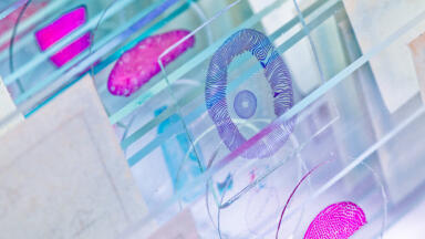 Ultimate Control for Immunohistochemistry and in situ Hybridisation??