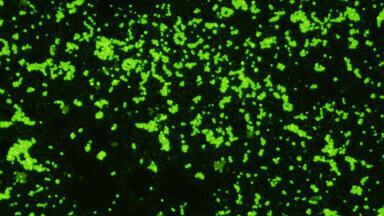 New Rabbit Monoclonal Antibody to Group A Strep