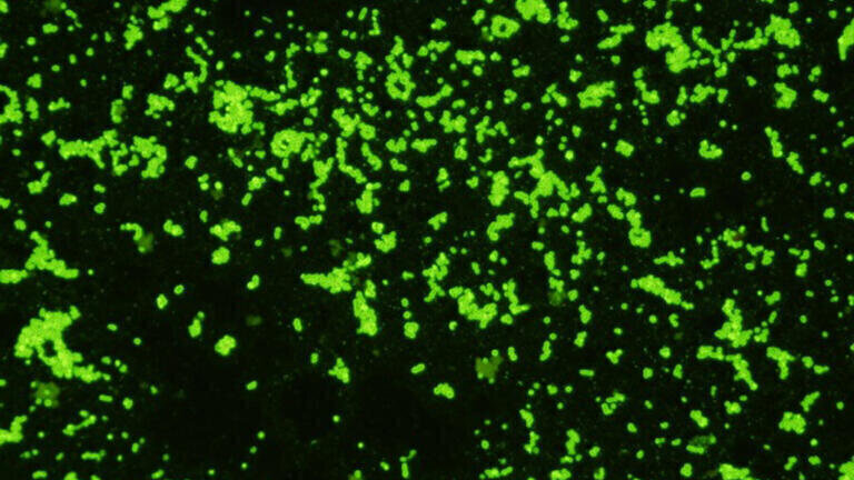 New Rabbit Monoclonal Antibody to Group A Strep