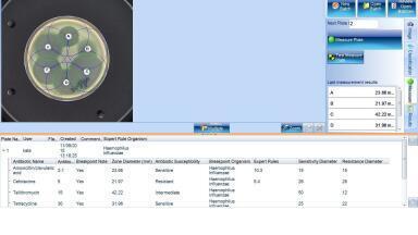 mASTer Software Speeds up Diagnosis of Superbug Antibiotic Resistance