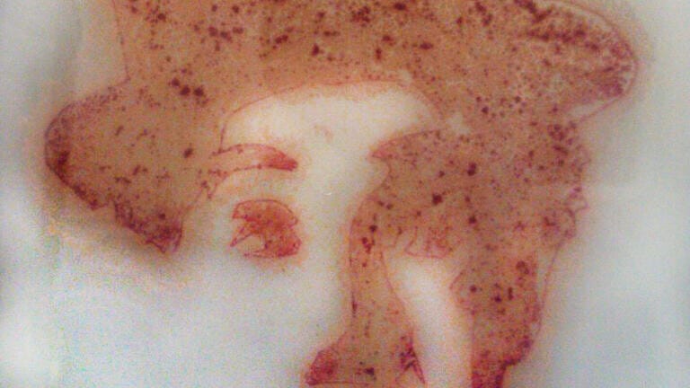 “Charlie Chaplin” (2nd Place)
Made by using an inoculating loop and a solution of Streptomyces lividans on R2 agar followed by incubation for 4 days. The red pigments are the antimicrobial agent undecylprodigiosin, produced naturally by S. lividans during their developmental cycle.
By Howbeer Muhamadali - Manchester Institute of Biotechnology
