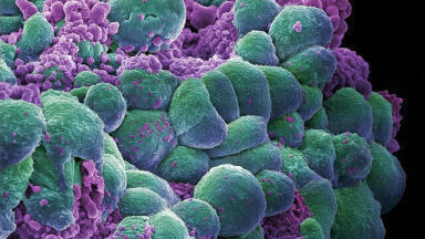 UK Scientists Use ‘Heat Seeking Grenades’ to Combat Cancer Cells
