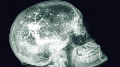 What Are the Uses of X-Rays?