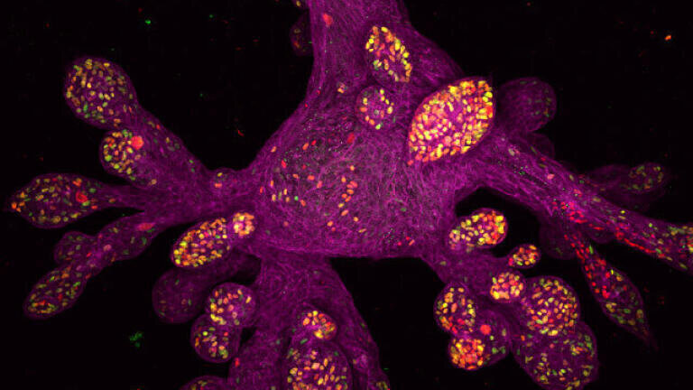 4. Daniel H. Miller & Ethan S. Sokol, Lab-grown human mammary gland organoid