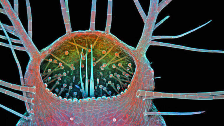 3. Dr. Igor Siwanowicz, Intake of a humped bladderwort (Utricularia gibba), a freshwater carnivorous plant