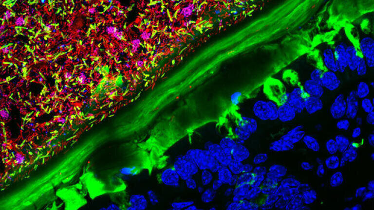 2. Kristen Earle, Gabriel Billings, KC Huang & Justin Sonnenburg, Mouse colon colonised with human microbiota