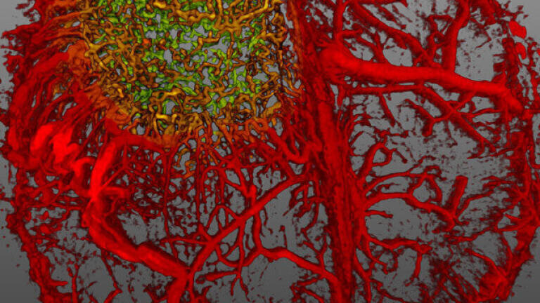 5. Dr. Giorgio Seano & Dr. Rakesh K. Jain, Live imaging of perfused vasculature in a mouse brain with glioblastoma