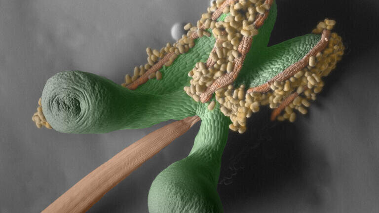 Commelina erecta anther - SEM image winner