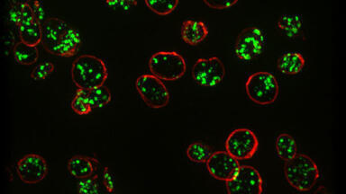 Super Resolution Microscopy Offers Method for Diagnosing Rare Bleeding Disorder