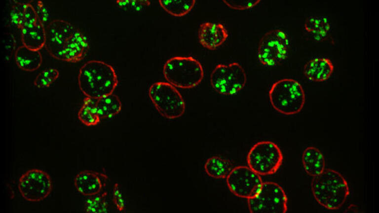 Super Resolution Microscopy Offers Method for Diagnosing Rare Bleeding Disorder