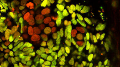 Resisting change: Stem Cells Remain Young