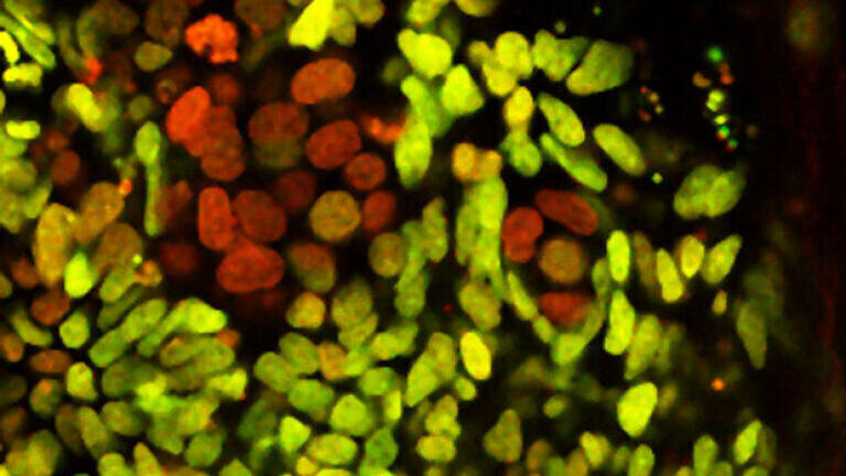 Resisting change: Stem Cells Remain Young