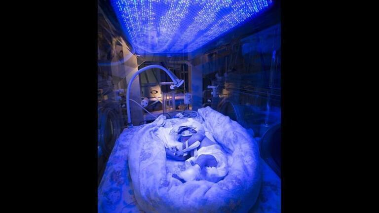 Premature Baby receiving Light Therapy- David Bishop, Royal Free Hospital, London - 2nd place 