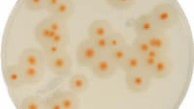 New Rapid Culture Method for Enumeration of Bacillus cereus in Food Products