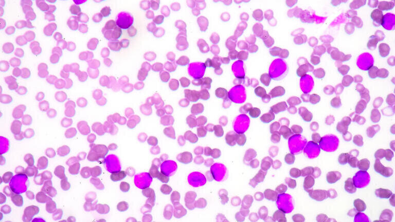 Custom Cell and Tissue Sourcing Service Announced