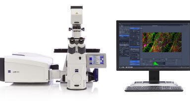 Fast Acquisition Mode for LSM 880 with Airyscan Introduced
