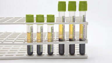 CE Mark for Next Generation Blood Separation Technology Received