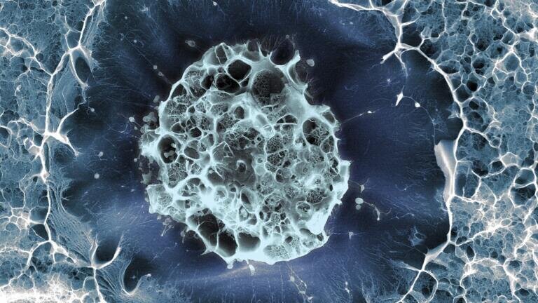 Human STEM Cell Credit: A Ferreira, Cristina Lopo and Eileen Gentleman, King’s College London.
A stem cell, which can make some of the other types of cells found in the body. This one was taken from inside a person’s hip bone and was put in a mixture of chemicals made to be like where the cell lives inside the body. The cell is about 15 micrometres (0.015 mm) across.
