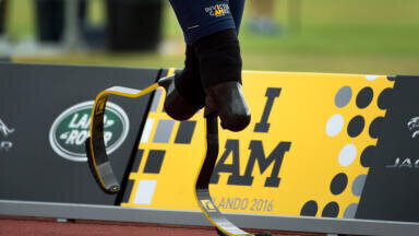 When Were Prosthetic Limbs Invented?