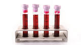 New Clinical Specimen Panels Speed Up Assay Development for Infectious Diseases