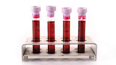 New Clinical Specimen Panels Speed Up Assay Development for Infectious Diseases
