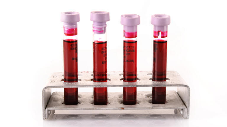 New Clinical Specimen Panels Speed Up Assay Development for Infectious Diseases