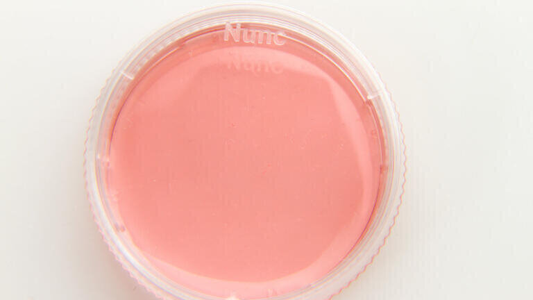 Thermo Scientific Nunc EasYDish