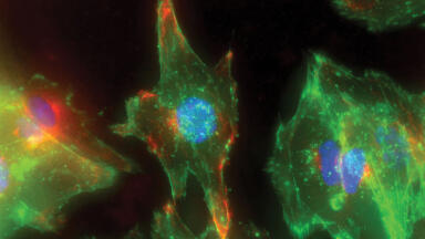 Lonza’s RAFT™ 3D Cell Culture System Enables Corneal Modeling for Research into Potential Blindness Cure