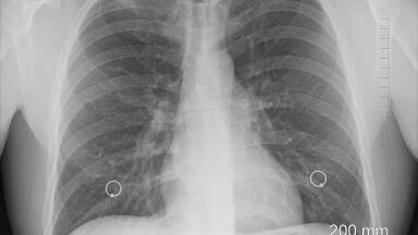 How Does Breathing Affect Your Brain?