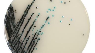 Neogen Develops Superior Chromogenic Media for Salmonella