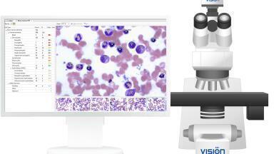 Automated Analysis of Bone Marrow Cells