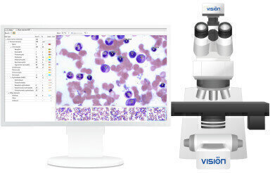 Automated Analysis of Bone Marrow Cells