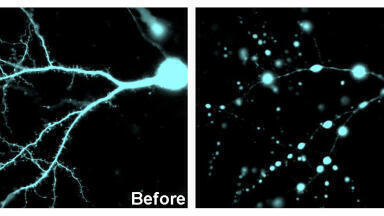 Stimulating Neurons Could Protect Against Brain Damage