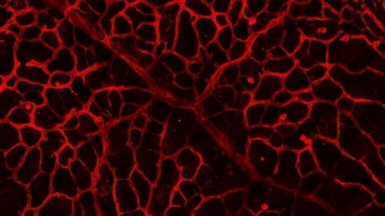 UCD Takes Lead on Cancer and Ophthalmic Research