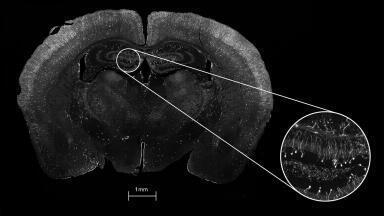 New Class of Confocal Microscope Scans Large Areas at High-Speed