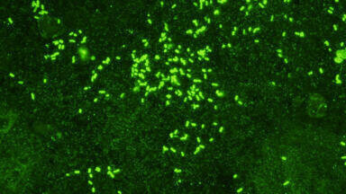 New Shigella Monoclonal Antibodies