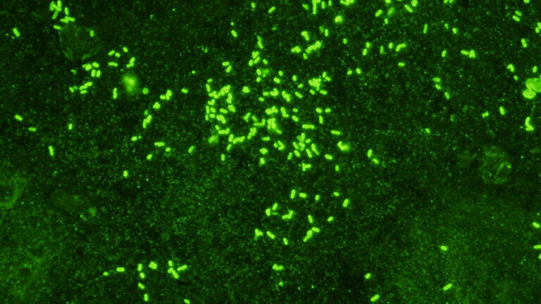 New Shigella Monoclonal Antibodies