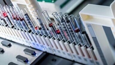 Enhance your Workflow Efficiency with Rapid Tube Identification