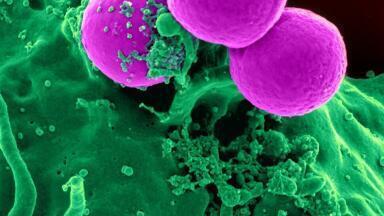 What are Retired Cells?