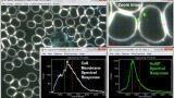 Hyperspectral Imaging of Gold Nanoparticles in Live Blood Cells