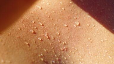 What’s Normal When It Comes to Sweat? 