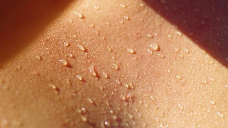 What’s Normal When It Comes to Sweat? 
