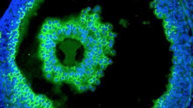 ELISA-like Assay for Hyaluronic Acid