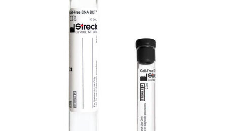 New Blood Collection Tubes Stabilise Nucleated Blood Cells   